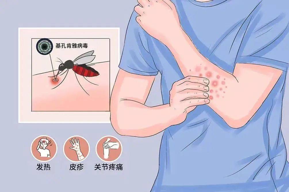 皇冠信用网登2代理_风险增大皇冠信用网登2代理！深圳疾控：去这247处要小心！张文宏首次发声