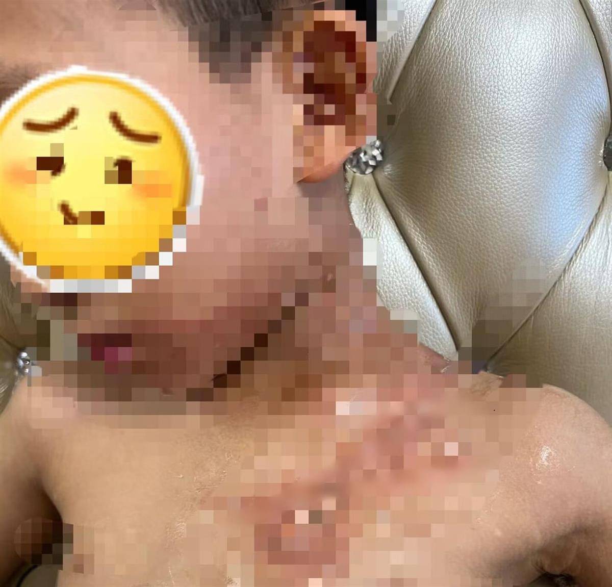 餐厅服务员端着酸菜鱼“追尾”撞上男孩巴黎圣日耳曼vs朗斯，致其被热汤烫伤胸口，合肥警方介入 | 巴黎圣日耳曼vs朗斯